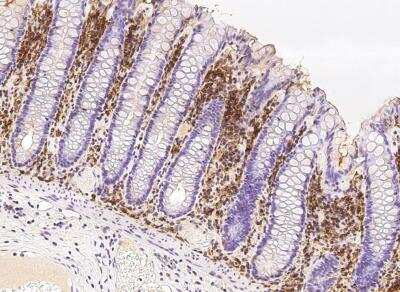 Immunohistochemistry-Paraffin: Proapoptotic Caspase Adaptor Protein Antibody [NBP2-97099]