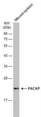 Western Blot: Proapoptotic Caspase Adaptor Protein Antibody [NBP1-31619]