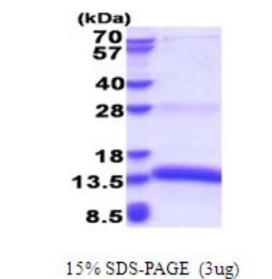 SDS-PAGE: Recombinant Human Proapoptotic Caspase Adaptor Protein His Protein [NBP2-51645]