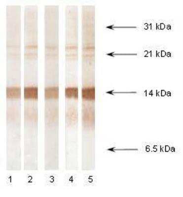 Western Blot: Procalcitonin Antibody (27A3cc) [NB110-13042]