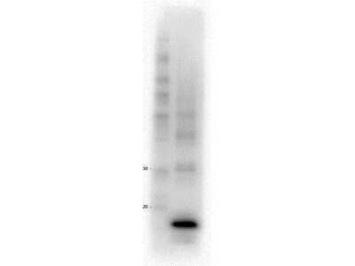 Western Blot: Procalcitonin Antibody (4D12.D4.F3.E2.H7.E7) [NBP2-44104]