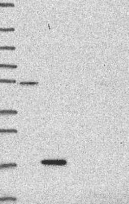 Western Blot: Procalcitonin Antibody [NBP3-16983]