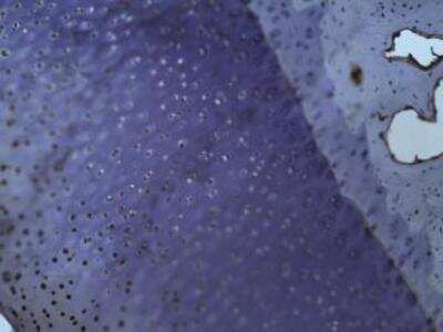 Immunohistochemistry: Collagen II Antibody (2) - BSA Free [NBP1-05169]