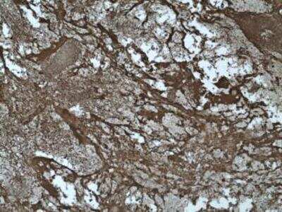 Immunohistochemistry: Collagen II Antibody (2) - BSA Free [NBP1-05169]