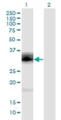 Western Blot: Proenkephalin Antibody (9E7) [H00005179-M04]