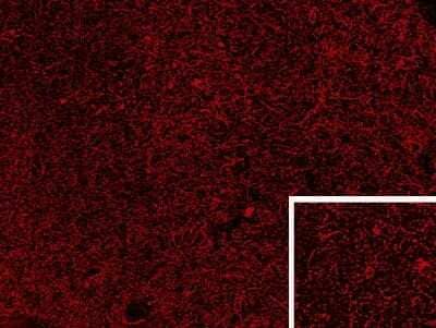 Immunohistochemistry-Frozen: Proenkephalin Antibody [NBP1-06066]