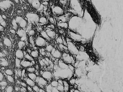 Immunohistochemistry-Frozen: Proenkephalin Antibody [NBP1-20963]