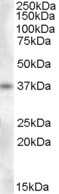 Western Blot: Proenkephalin Antibody [NBP1-06066]