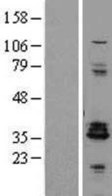 Western Blot: Proenkephalin Overexpression Lysate [NBL1-14289]