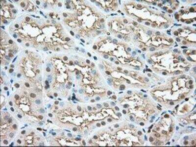 Immunohistochemistry-Paraffin: Profilin 1 Antibody (OTI1D5) [NBP2-02577]