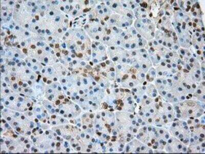 Immunohistochemistry-Paraffin: Profilin 1 Antibody (OTI1D5) [NBP2-02577]