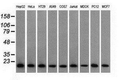 Western Blot: Profilin 1 Antibody (OTI1D5) [NBP2-02577]