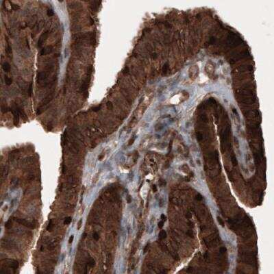 Immunohistochemistry-Paraffin: Profilin 1 Antibody (CL3524) [NBP2-59778]