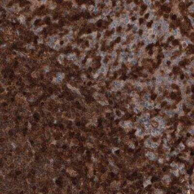 Immunohistochemistry-Paraffin: Profilin 1 Antibody (CL3524) [NBP2-59778]