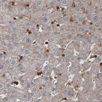 Immunohistochemistry-Paraffin: Profilin 1 Antibody (CL3524) [NBP2-59778]