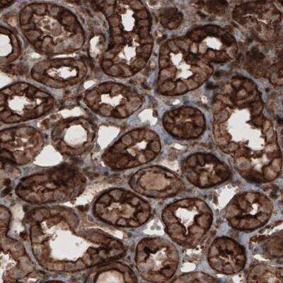 Immunohistochemistry-Paraffin: Profilin 1 Antibody (CL3524) [NBP2-59778]