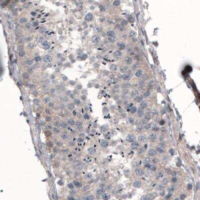 Immunohistochemistry-Paraffin: Profilin 1 Antibody (CL3524) [NBP2-59778]