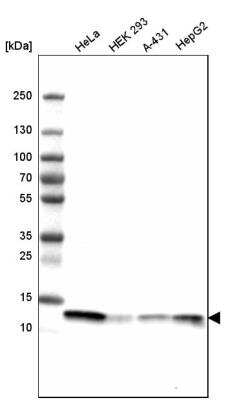 Western Blot: Profilin 1 Antibody (CL3524) [NBP2-59778]