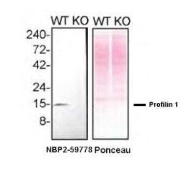 Knockout Validated: Profilin 1 Antibody (CL3524) [NBP2-59778]