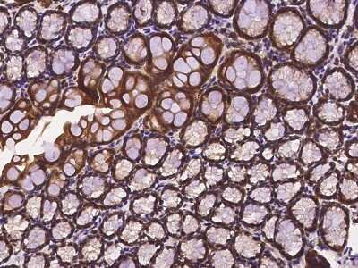 Immunohistochemistry-Paraffin: Profilin 1 Antibody [NBP2-99538]