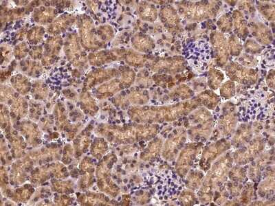 Immunohistochemistry-Paraffin: Profilin 1 Antibody [NBP2-99538]
