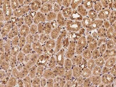 Immunohistochemistry-Paraffin: Profilin 1 Antibody [NBP2-99538]