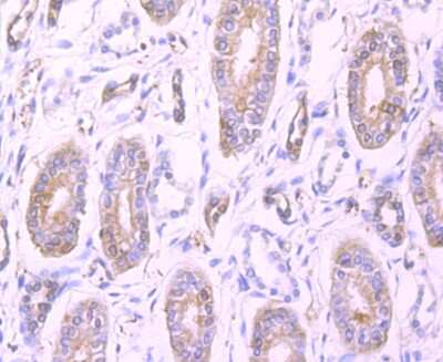 Immunohistochemistry-Paraffin: Profilin 1 Antibody (JA30-13) [NBP2-67078]