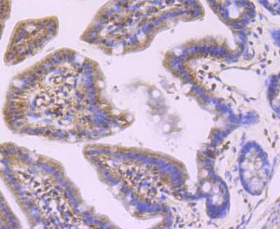 Immunohistochemistry-Paraffin: Profilin 1 Antibody (JA30-13) [NBP2-67078]