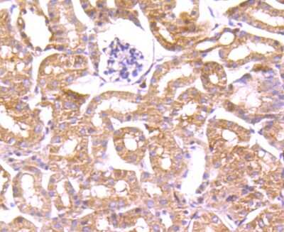 Immunohistochemistry-Paraffin: Profilin 1 Antibody (JA30-13) [NBP2-67078]