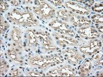 Immunohistochemistry: Profilin 1 Antibody (OTI1D5) - Azide and BSA Free [NBP2-73605]