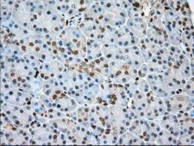 Immunohistochemistry: Profilin 1 Antibody (OTI1D5) - Azide and BSA Free [NBP2-73605]