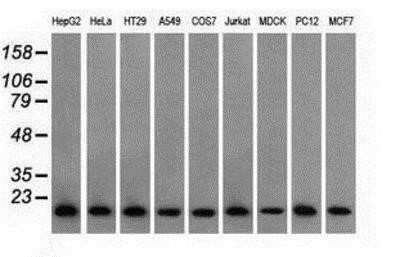 Western Blot: Profilin 1 Antibody (OTI1D5)Azide and BSA Free [NBP2-73605]