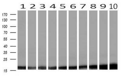 Western Blot: Profilin 1 Antibody (OTI1D5) [NBP2-02577]