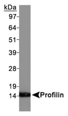 Western Blot: Profilin 1 AntibodyBSA Free [NBP1-19344]