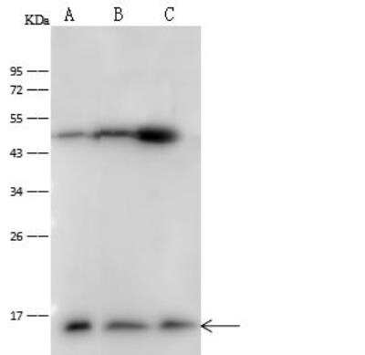 Western Blot: Profilin 1 Antibody [NBP2-99325]