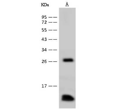 Western Blot: Profilin 1 Antibody [NBP2-99538]