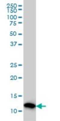 Western Blot: Profilin 2 Antibody (5F11) [H00005217-M04]