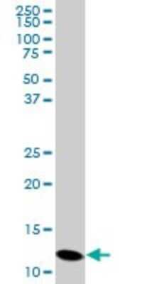 Western Blot: Profilin 2 Antibody (6G3) [H00005217-M05]