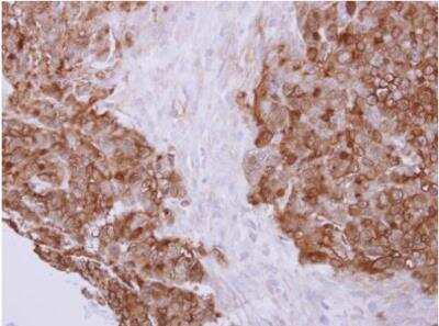Immunohistochemistry-Paraffin: Profilin 2 Antibody [NBP1-31629]