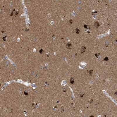 Immunohistochemistry-Paraffin: Profilin 2 Antibody [NBP1-87426]