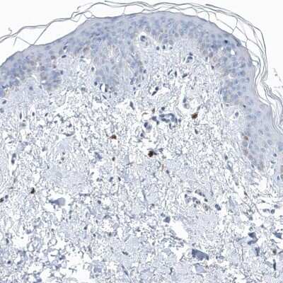 Immunohistochemistry-Paraffin: Profilin 2 Antibody [NBP1-87426]