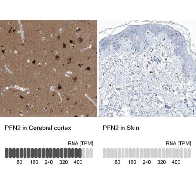 Immunohistochemistry-Paraffin: Profilin 2 Antibody [NBP1-87426]