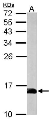 Western Blot: Profilin 2 Antibody [NBP1-31629]