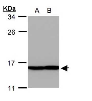 Western Blot: Profilin 2 Antibody [NBP1-31629]