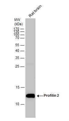 Western Blot: Profilin 2 Antibody [NBP1-31629]