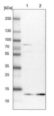 Western Blot: Profilin 2 Antibody [NBP1-87426]