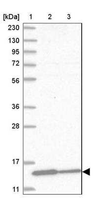 Western Blot: Profilin 2 Antibody [NBP1-87426]