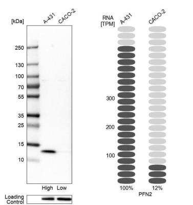 Western Blot: Profilin 2 Antibody [NBP1-87426]
