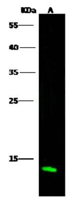 Western Blot: Profilin 2 Antibody [NBP3-00301]