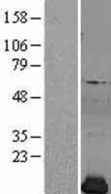 Western Blot: Profilin 2 Overexpression Lysate [NBL1-14319]